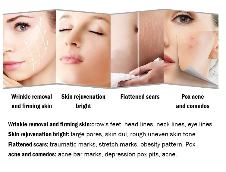 piranti microneedling RF
