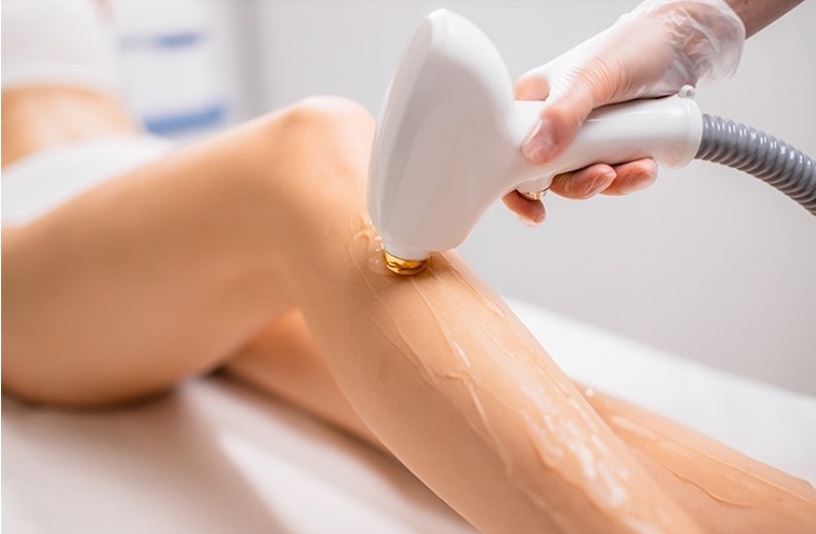 Will Hair Grow Back After Diode Laser? Unveiling the Truth Behind Diode Laser Hair Removal