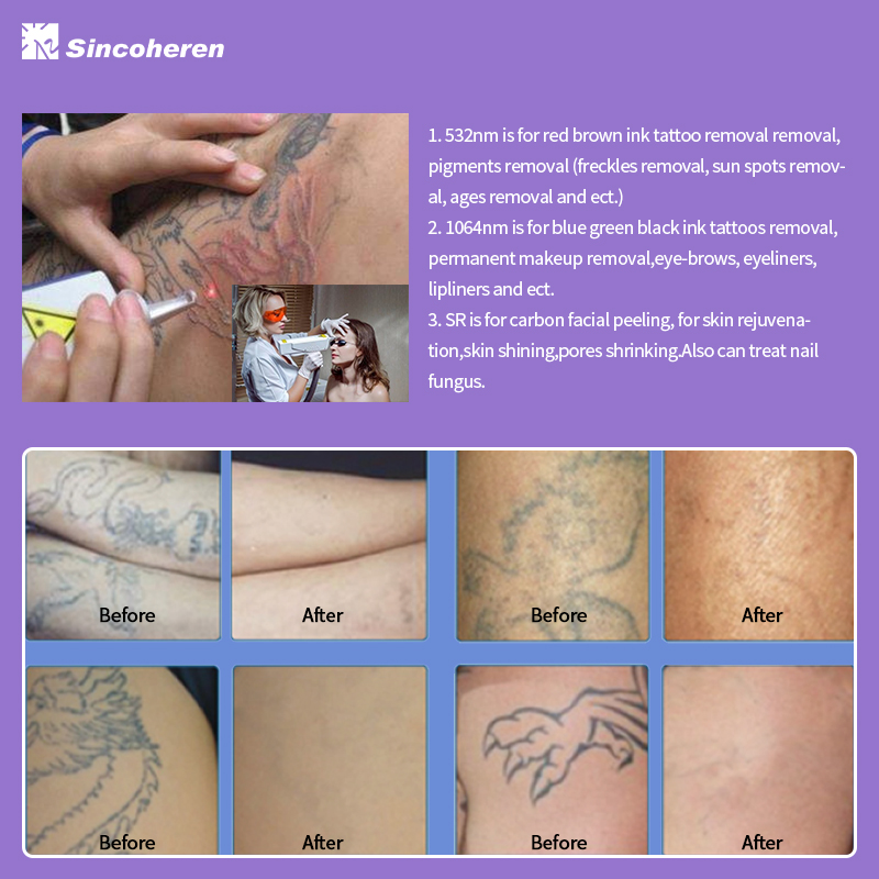 How long after Pico laser will I see results?