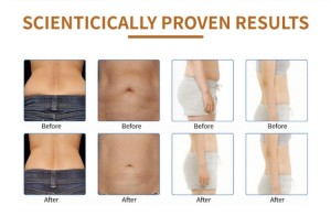 kuma Pro cavitation slimming