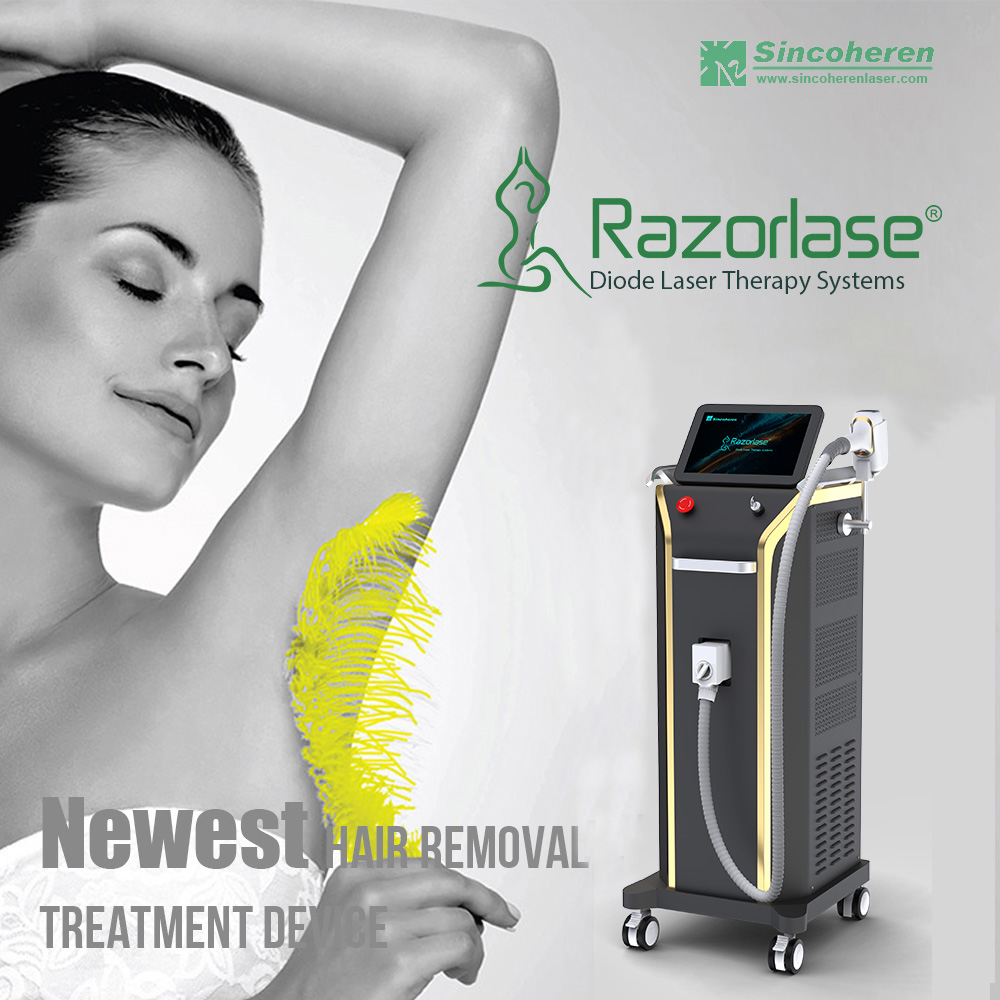 How permanent is a diode laser?