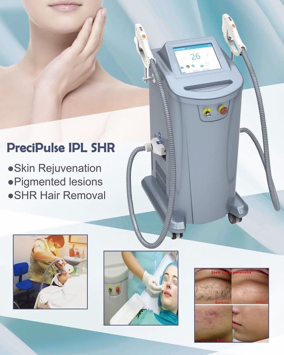 Does IPL Really Remove Hair Permanently?