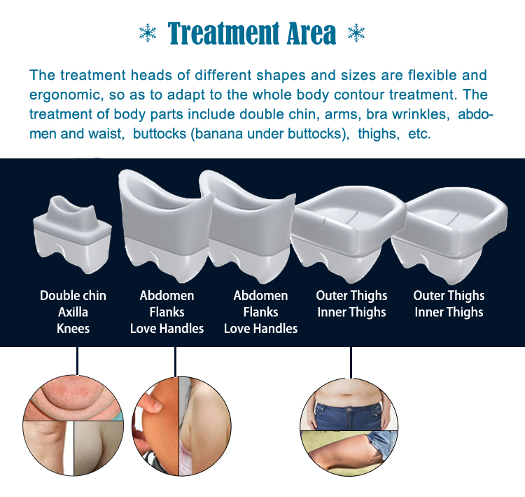 How long does cryo slimming results last?